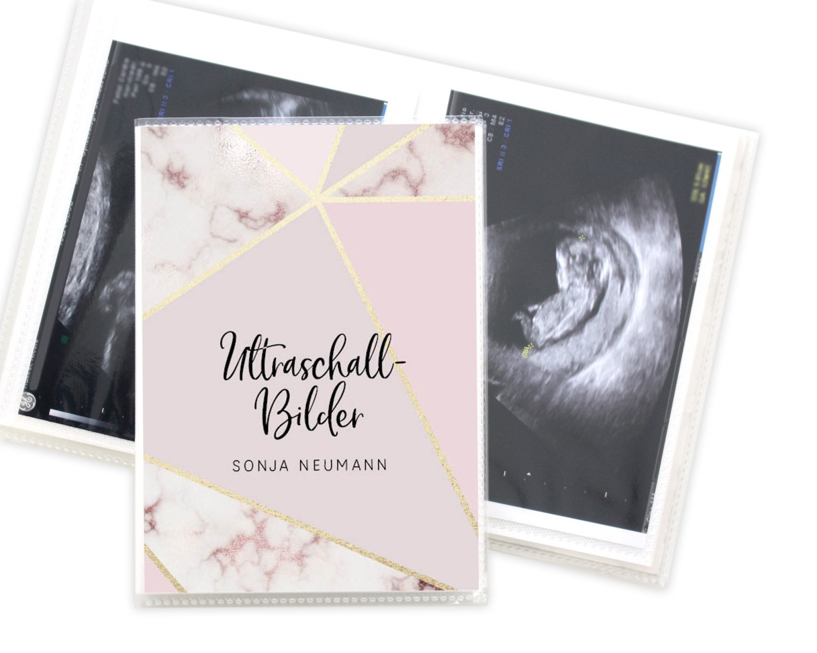 Ultraschallbilder-Mappe Hülle Aufbewahrung personalisiert Marmor gold rosa altrosa 2